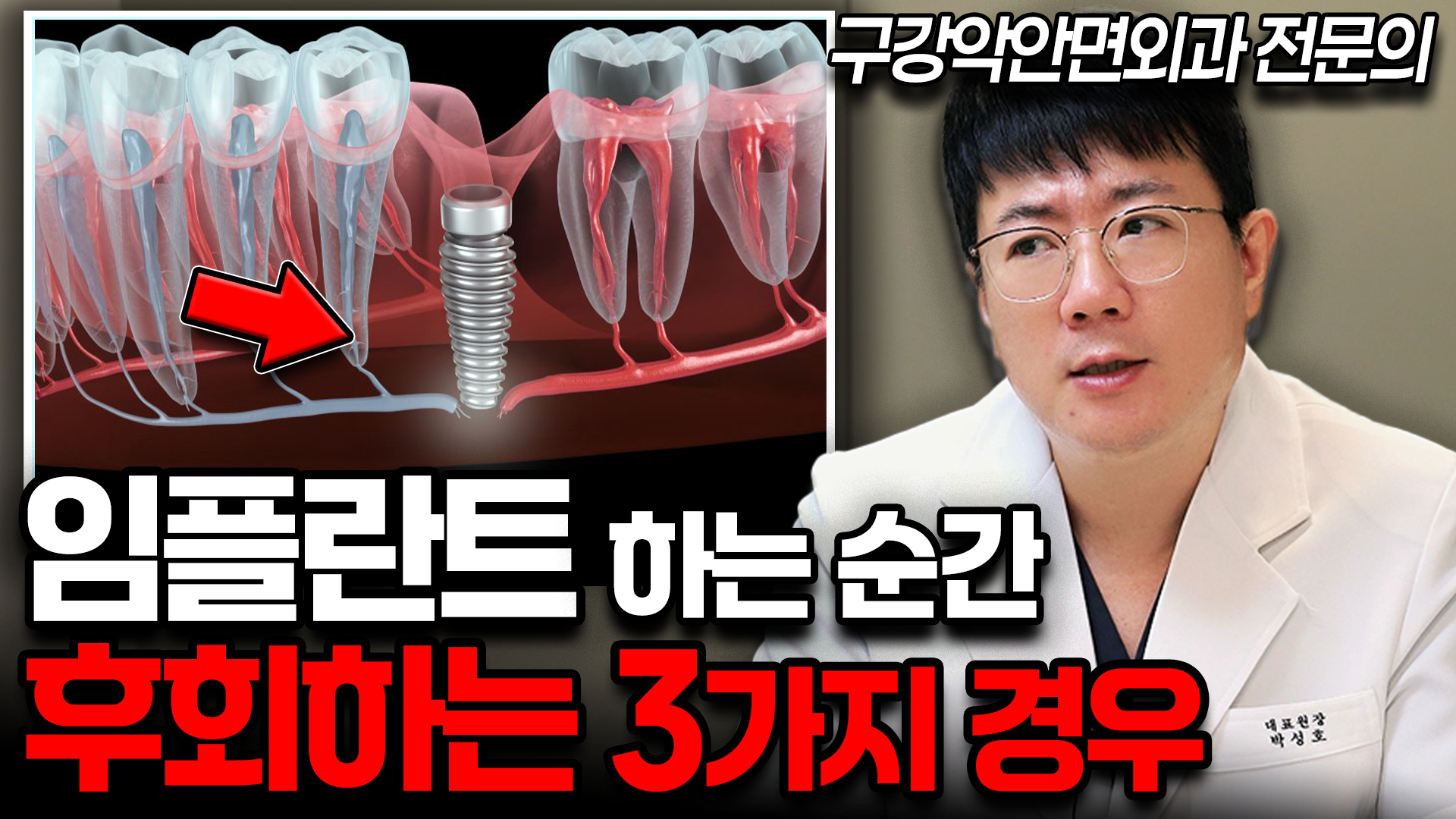 부작용 피하려면 이렇게 하세요