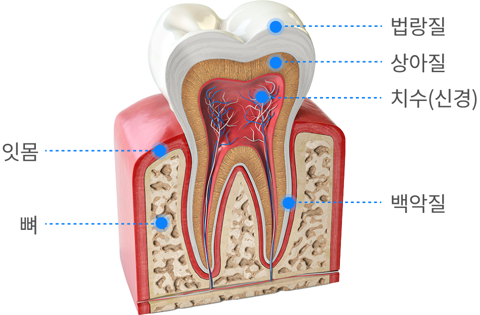 치아모형-법랑질, 상아질, 치수(신경), 백악질, 잇몸, 뼈