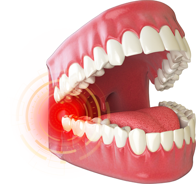 치아 모형